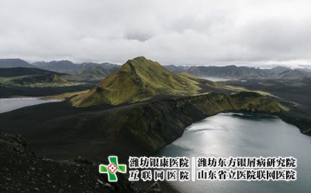 黑豆馏油软膏可以治银屑病吗?治牛皮癣好不好