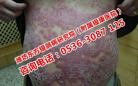 遗传病是遗传发生的吗