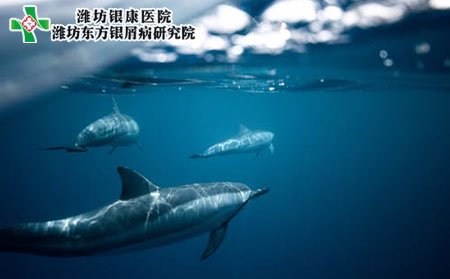 银屑病的治疗方法有哪些?紫外线有用吗?